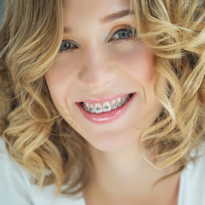 A woman with straight teeth and braces smiles at the camera.